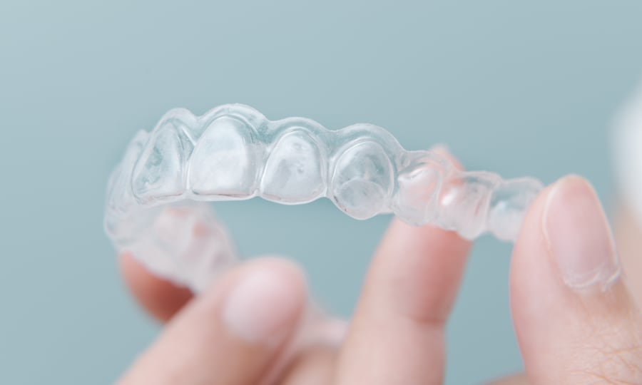 Smooth construction of invisalign